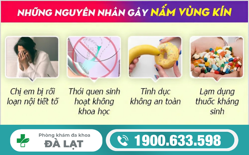 Hình ảnh minh họa